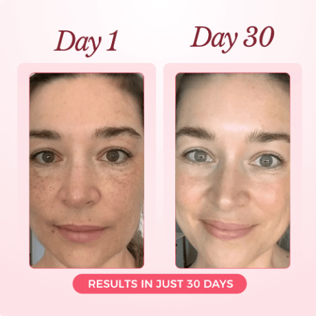 SeraGlow | Rejuvenation Collagen Mask