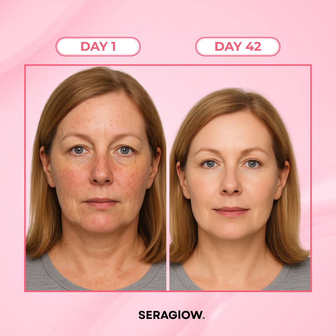 SeraGlow | LED Therapy Kit