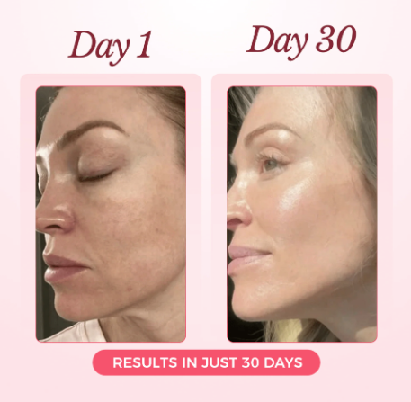 SeraGlow | Rejuvenation Collagen Mask