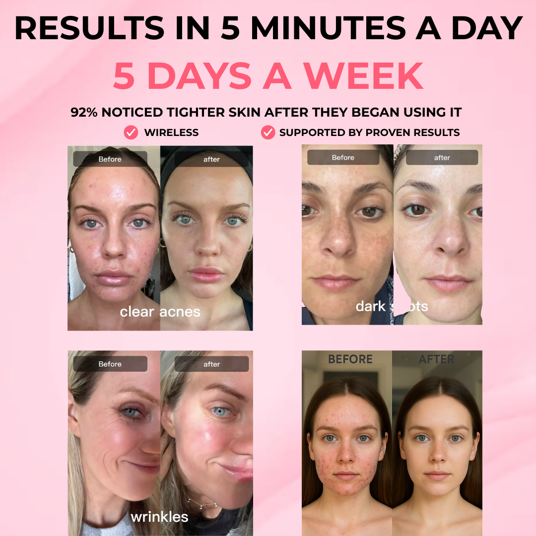 SeraGlow | LED Therapy Kit